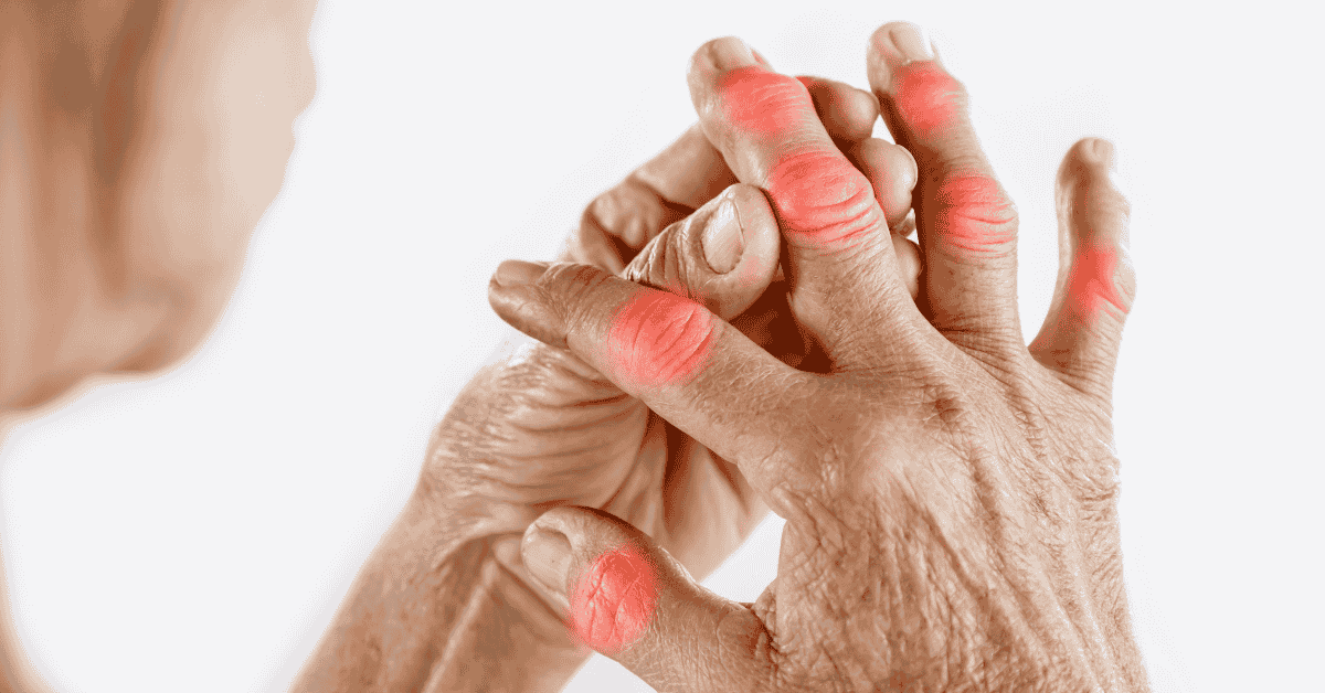 Laser Therapy for Arthritis: Improving Joint Health and Mobility