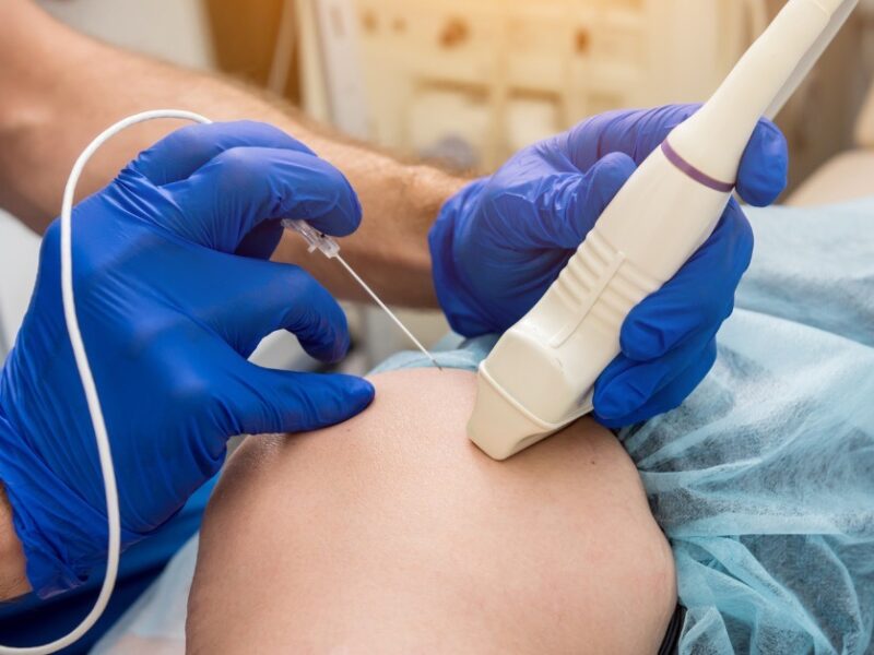 Top 5 Advanced Pain Management Treatments Recommended by Doctors