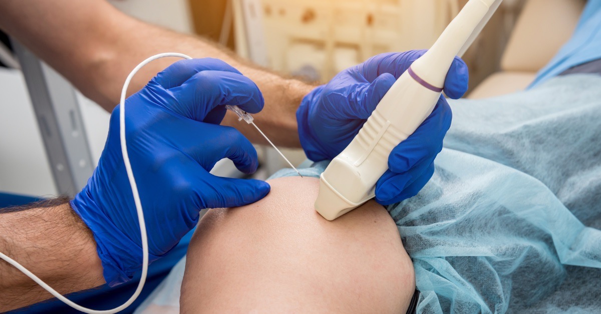 Top 5 Advanced Pain Management Treatments Recommended by Doctors