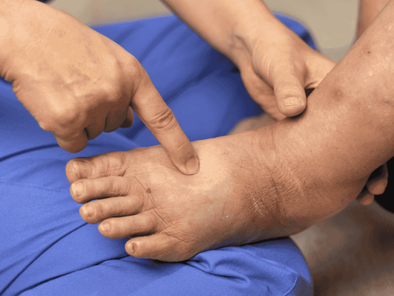 How Chronic Inflammation Contributes to Pain — and What Can Be Done About It