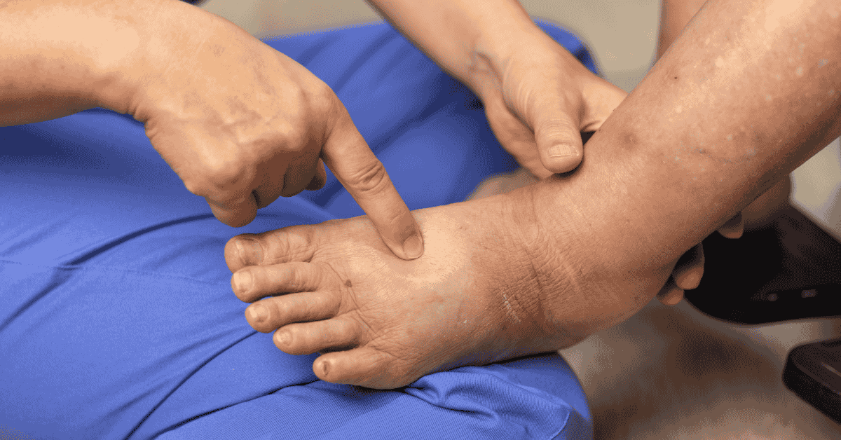 How Chronic Inflammation Contributes to Pain — and What Can Be Done About It How Chronic Inflammation Contributes to Pain — and What Can Be Done About It