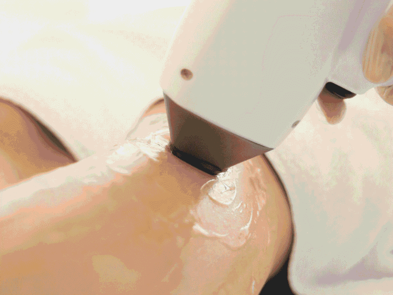 What Is Laser Therapy for Pain? Benefits, Costs, and What to Expect
