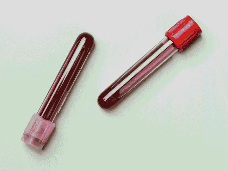 PRP Therapy for Joint Pain: Does It Really Work?