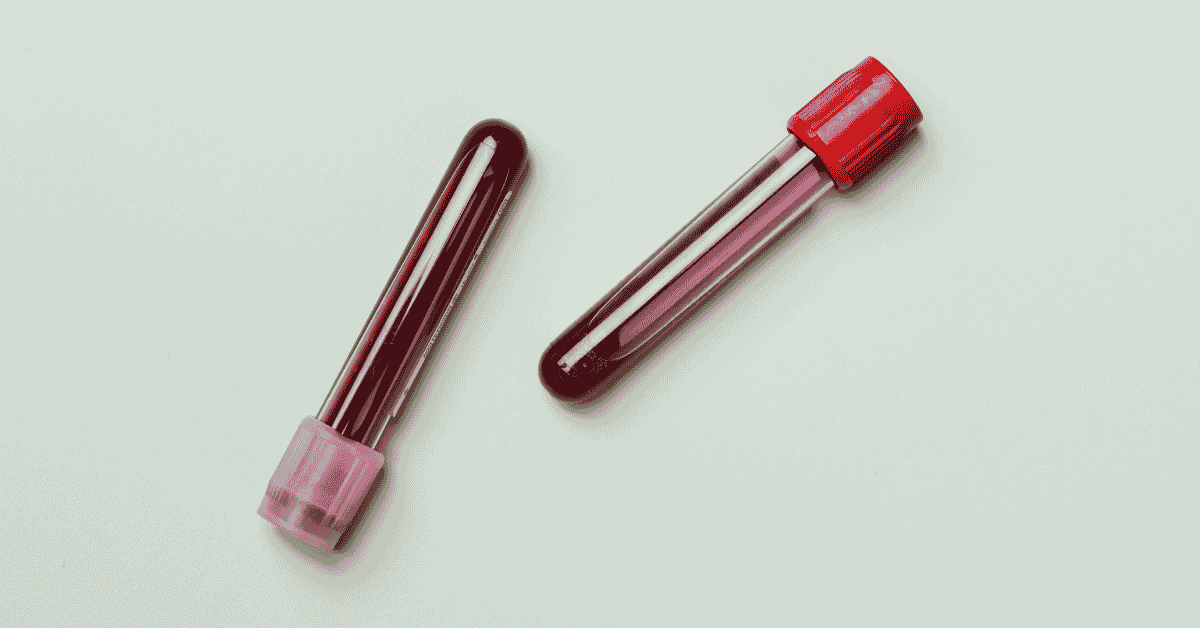 PRP Therapy for Joint Pain: Does It Really Work?